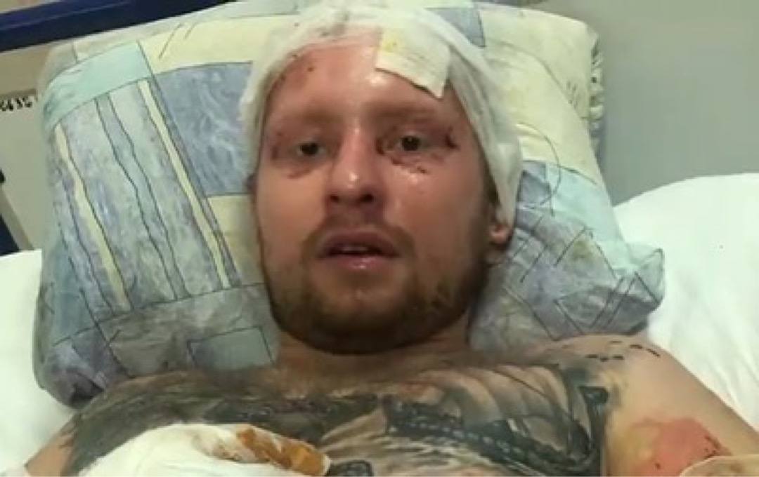 Проект «Неопалимые» от Александра Туркевича | Alfaspa изображение 2